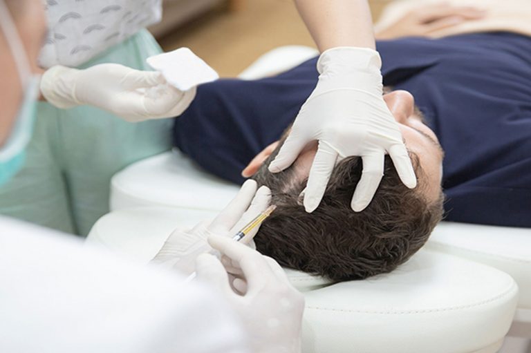 Qu’est-ce que le traitement PRP dans les cheveux et comment est-il appliqué ?